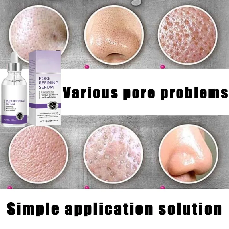 Текстура кожи | Pore Refining Resurfacing Мощная усадочная сыворотка для подтяжки и удаления больших пор на лице
Текстура кожи | Pore Refining Resurfacing Мощная усадочная сыворотка для подтяжки и удаления больших пор на лице