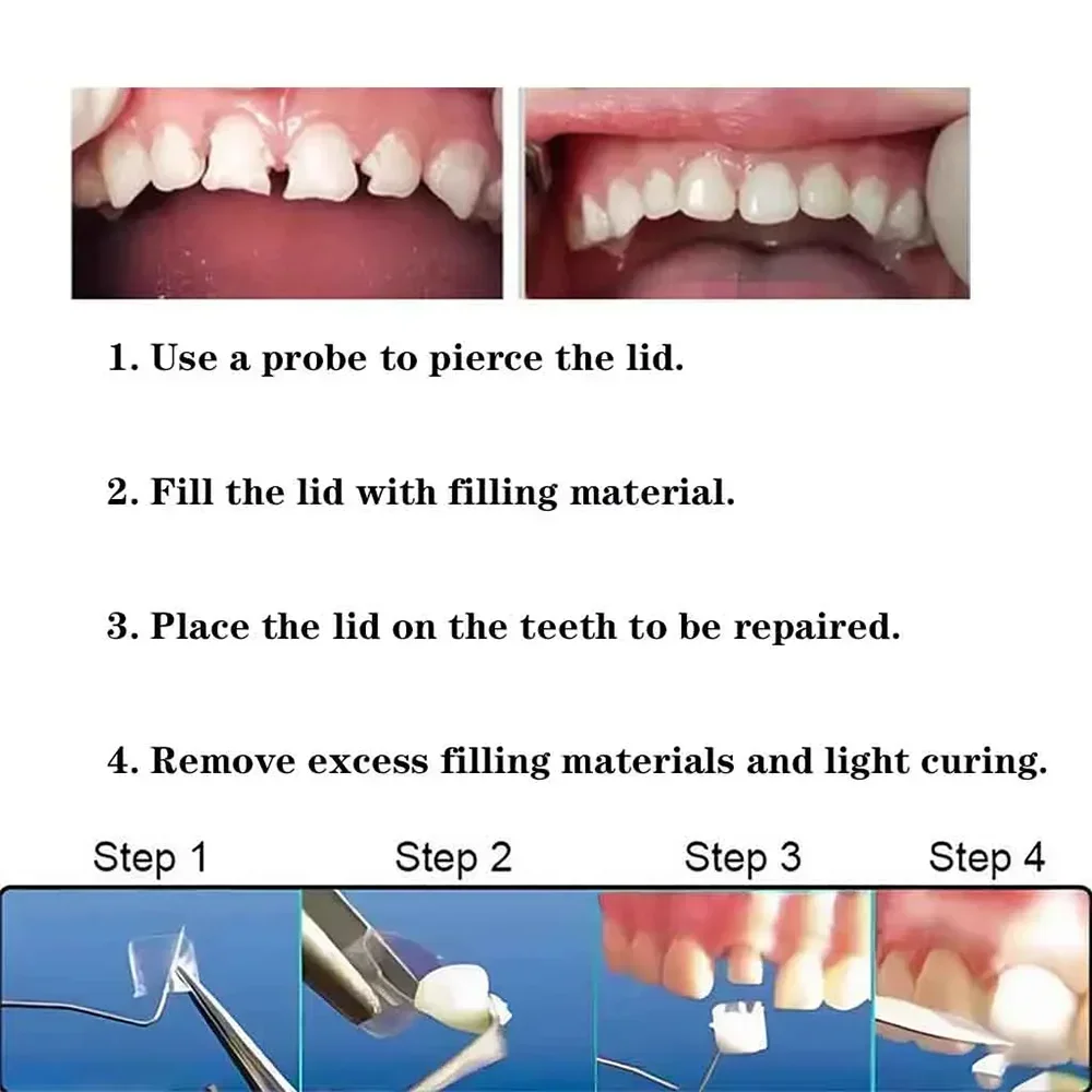 64Pcs/box Adult Kidsteeth Transparent Crowns Dental Anterior Posterior Deciduous Temporary Molar Tooth Crown Child 1.910/1.912
64Pcs/box Adult Kidsteeth Transparent Crowns Dental Anterior Posterior Deciduous Temporary Molar Tooth Crown Child 1.910/1.912