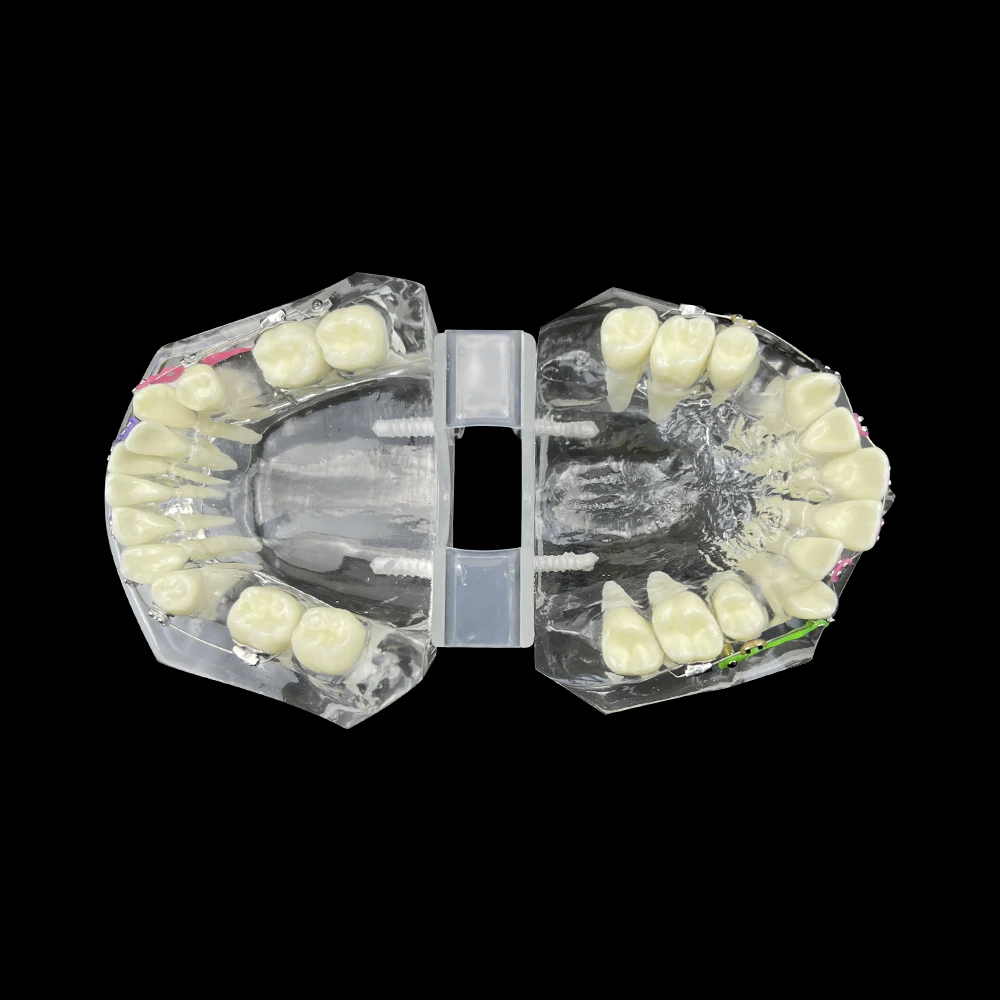 1 шт. Стоматологическая ортодонтическая модель с опорными штифтами для зуботехнической практики
1 шт. Стоматологическая ортодонтическая модель с опорными штифтами для зуботехнической практики