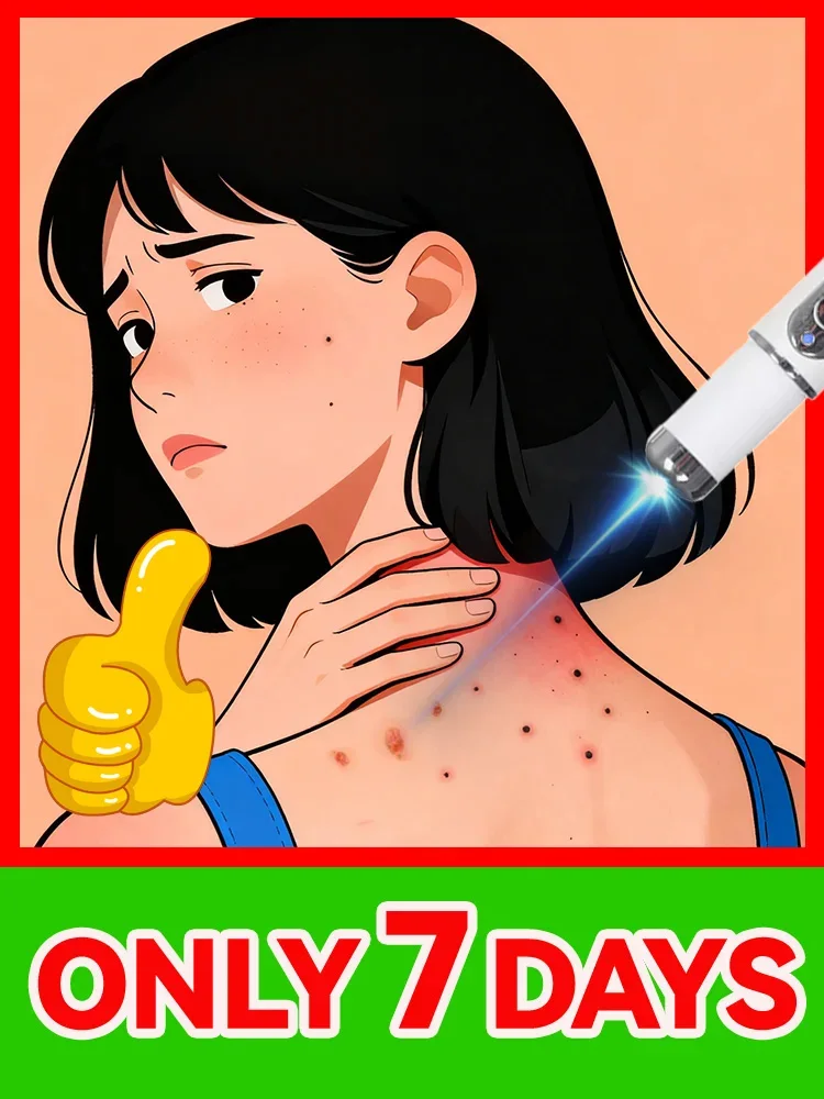 Модернизированные бородавки 2-го поколения , восстановление корня бородавок
Модернизированные бородавки 2-го поколения , восстановление корня бородавок