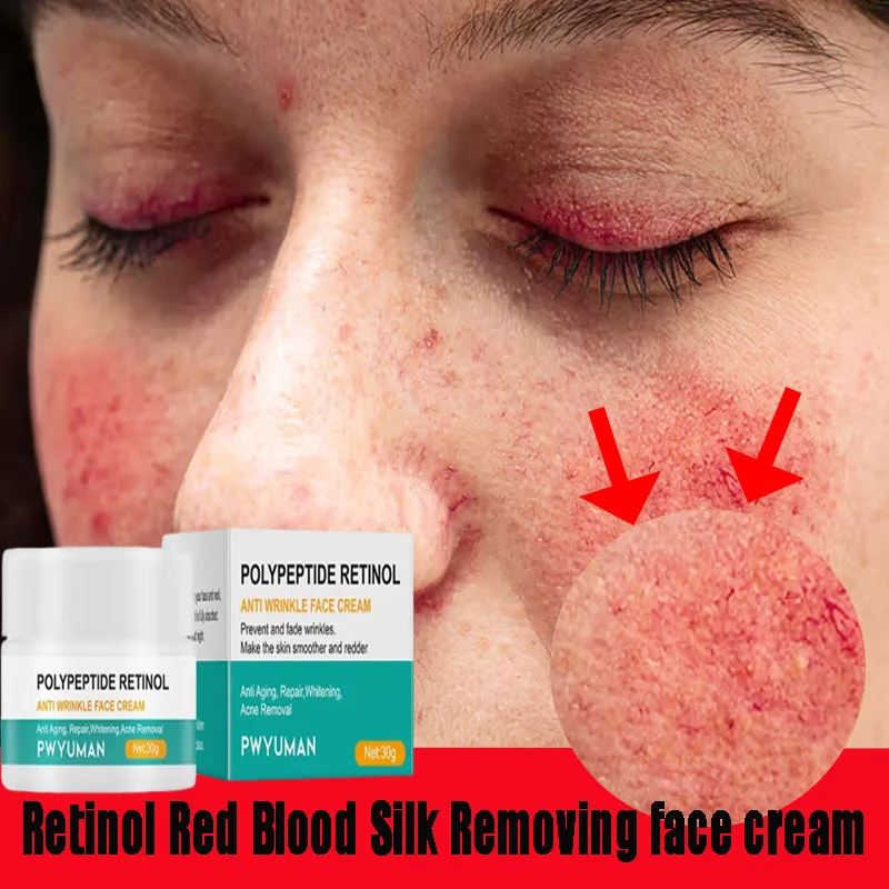 Восстанавливающий крем для лица, мгновенный крем от покраснений, для удаления чутливой кожи, успокаивающий лосьон против покраснений, розасины, корейская косметика
Восстанавливающий крем для лица, мгновенный крем от покраснений, для удаления чутливой кожи, успокаивающий лосьон против покраснений, розасины, корейская косметика