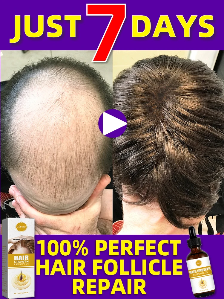 98% of buyers buy again, have more and more hair, say goodbye to baldness, thick hair,Hot selling product
98% of buyers buy again, have more and more hair, say goodbye to baldness, thick hair,Hot selling product
