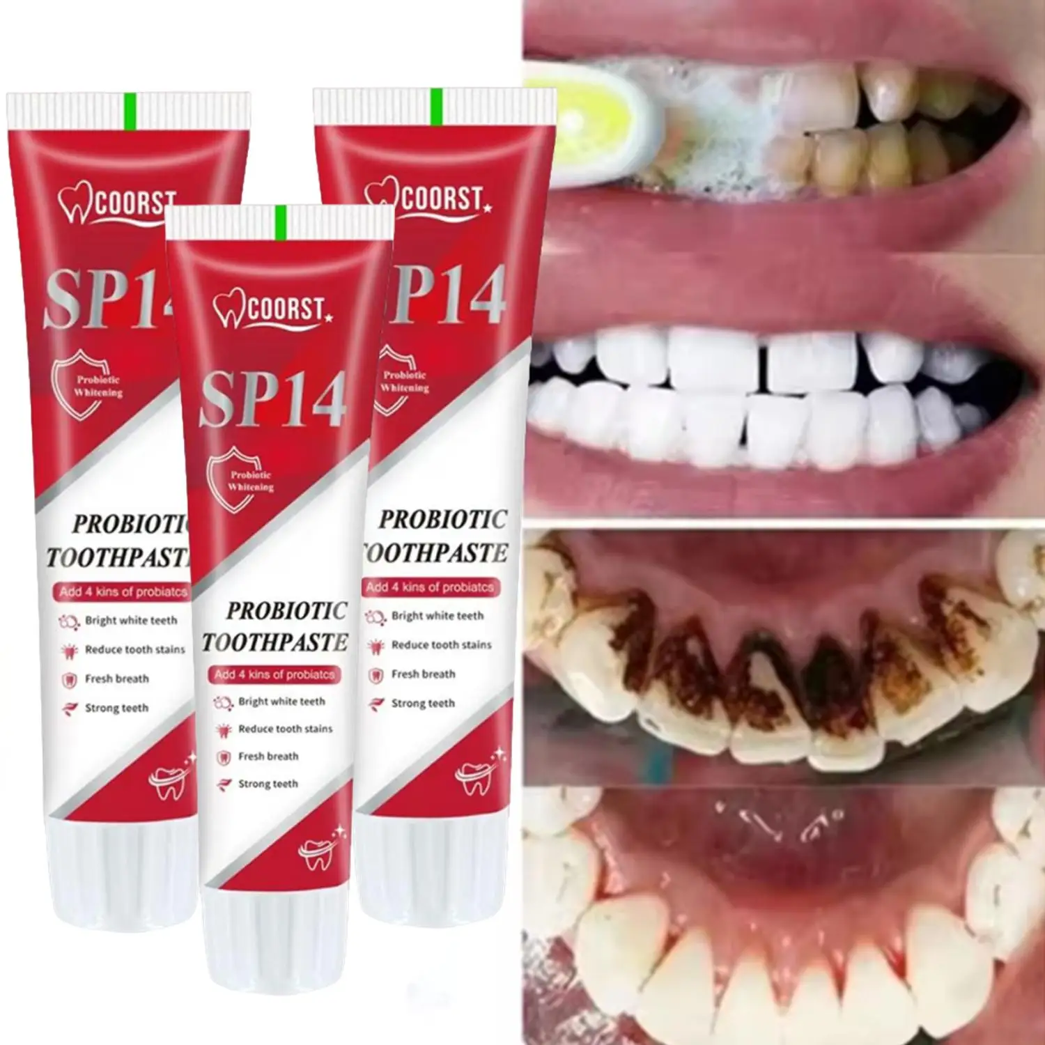 SP14 Probiotic Toothpaste Whiten Clean Teeth Remove Stains Management Fresh Breath With Sodium Saccharin Lactobacillus 3Pcs
SP14 Probiotic Toothpaste Whiten Clean Teeth Remove Stains Management Fresh Breath With Sodium Saccharin Lactobacillus 3Pcs