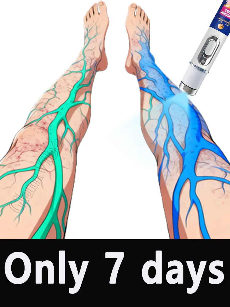 Один легкий трюк для снятия непрофекций и ты выглядит хорошо в них.
Один легкий трюк для снятия непрофекций и ты выглядит хорошо в них.