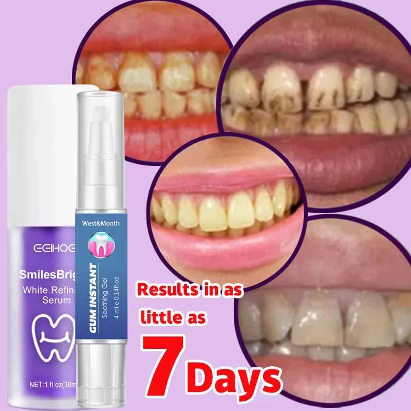 Purple Corrector Toothpaste Remove Stains Reduce Yellowing Care For Teeth Gums Fresh Breath Brightening Teeth Care Gel Product
Purple Corrector Toothpaste Remove Stains Reduce Yellowing Care For Teeth Gums Fresh Breath Brightening Teeth Care Gel Product