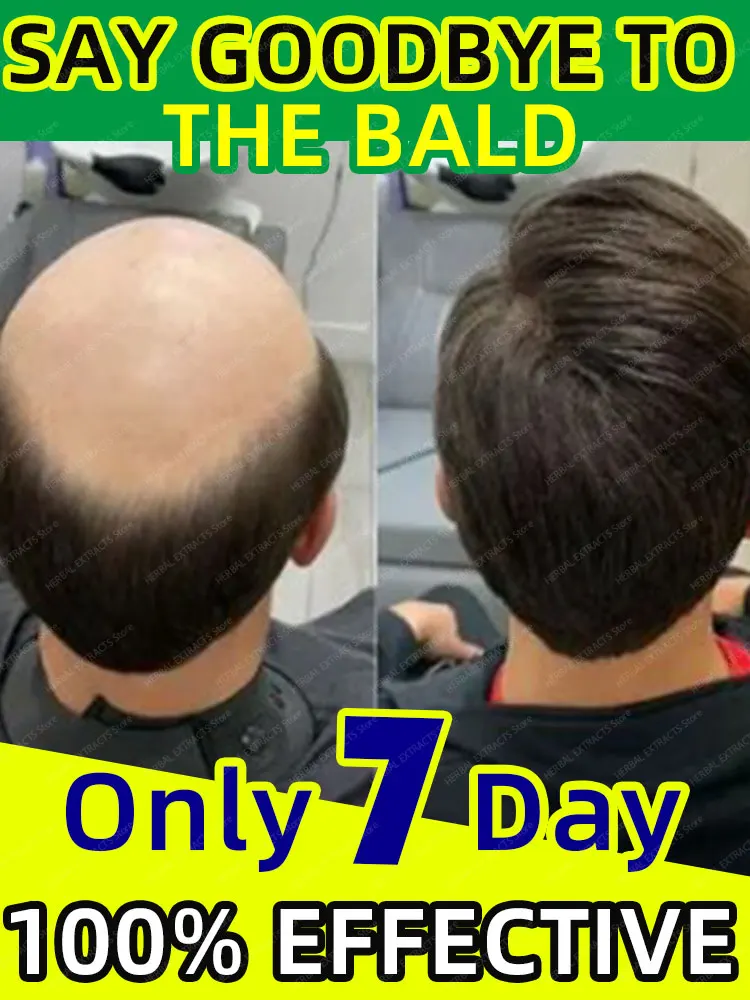 Óleo de crescimento do cabelo crescimento rápido do cabelo eficaz reparação da calvície perda de cabelo hereditária post-parto p
Óleo de crescimento do cabelo crescimento rápido do cabelo eficaz reparação da calvície perda de cabelo hereditária post-parto p