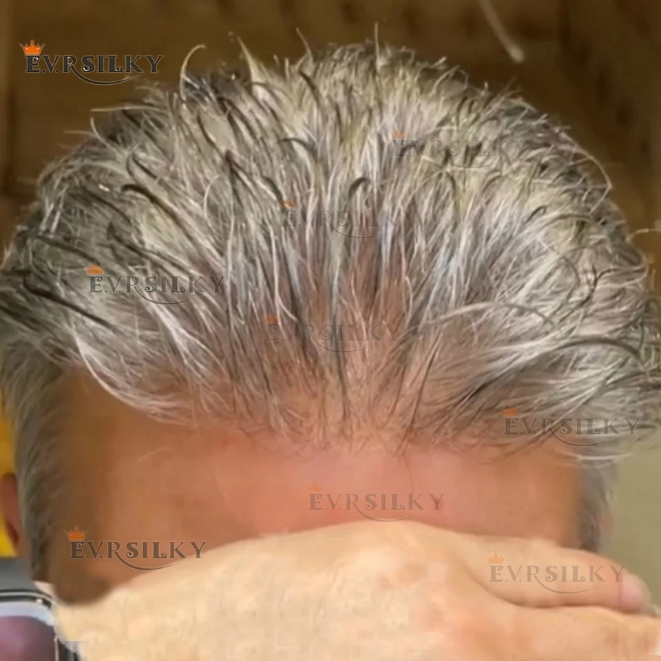 Супертонкая кожа серого цвета 1B80 565 # Мужской парик 0,02 мм, натуральная линия волос, незаметная, плотность 80%, мужской капиллярный протез, парик, система
Супертонкая кожа серого цвета 1B80 565 # Мужской парик 0,02 мм, натуральная линия волос, незаметная, плотность 80%, мужской капиллярный протез, парик, система