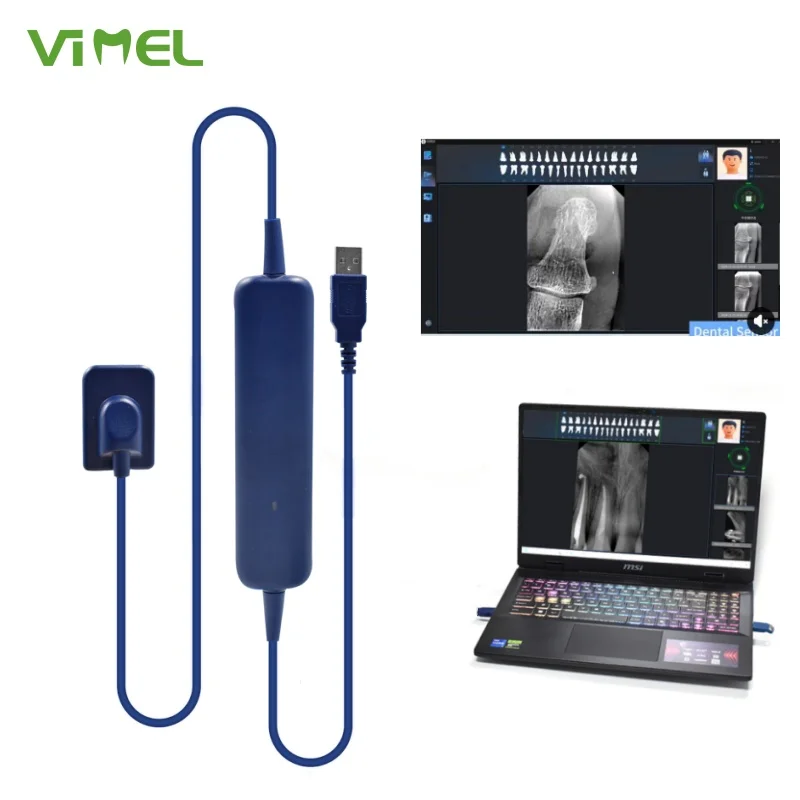 2025 Fast Imaging NEW Dental RVG Sensor Soft Surface Stable Stronger Magnetic Dental X-Ray less radiation
2025 Fast Imaging NEW Dental RVG Sensor Soft Surface Stable Stronger Magnetic Dental X-Ray less radiation