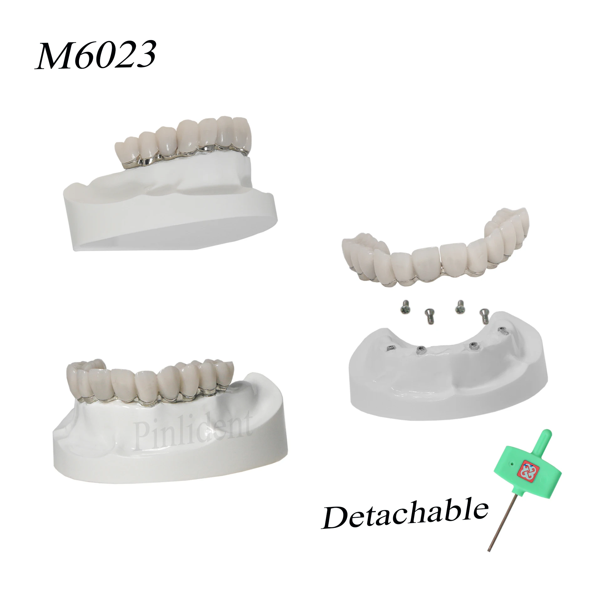 Dental Implant Overdenture Restoration Model Upper Jaw Restoration Model With 4 Implants Dentist Students Education Model M602
Dental Implant Overdenture Restoration Model Upper Jaw Restoration Model With 4 Implants Dentist Students Education Model M602