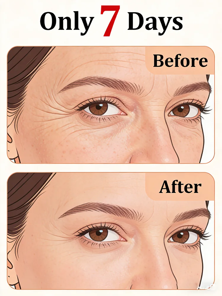 2026 Bestselling Facial Serum,No fine lines ,For wrinkles and does not look old For Smooth Delicate Complexion.
2026 Bestselling Facial Serum,No fine lines ,For wrinkles and does not look old For Smooth Delicate Complexion.