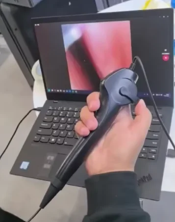 thumb
