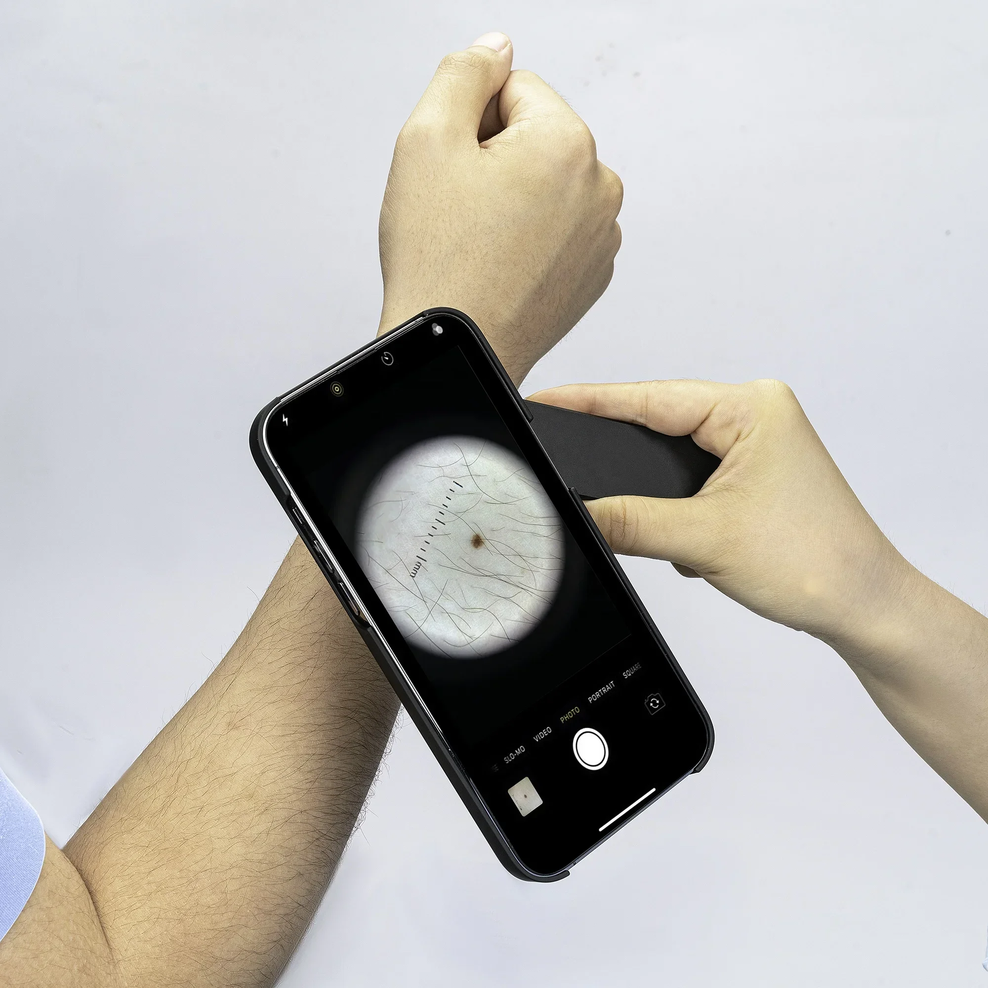 DE-4100 Handheld Dermatoscope With Polarized And Non Polarized Light For Skin Cancer