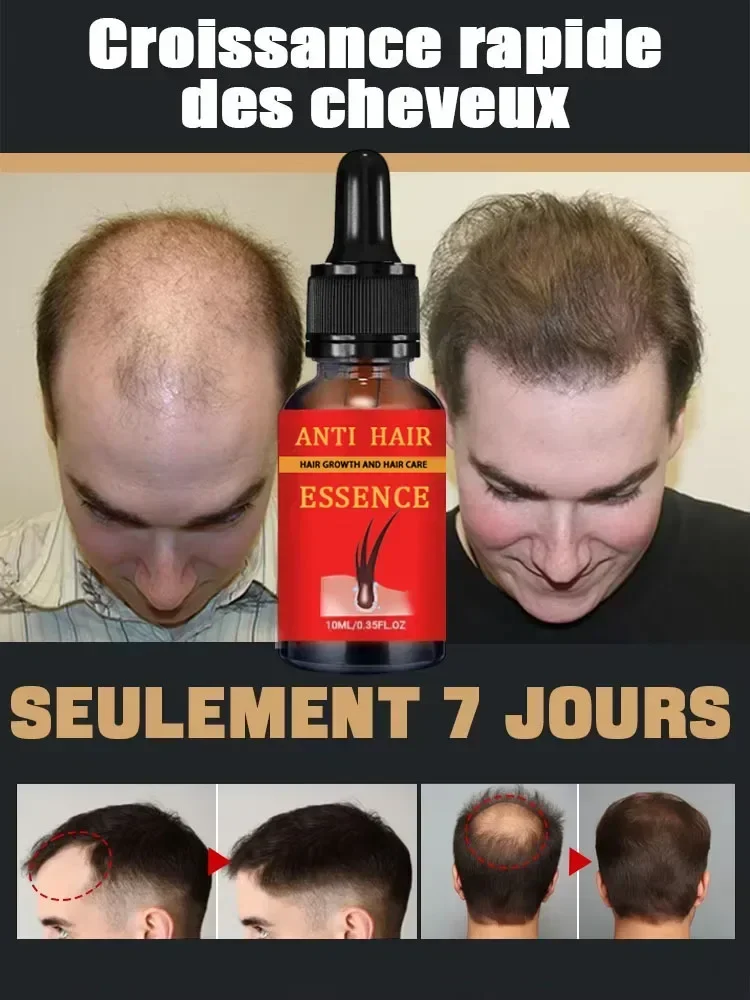 98% of buyers buy again, have more and more hair, say goodbye to baldness, thick hair,Hot selling product.
98% of buyers buy again, have more and more hair, say goodbye to baldness, thick hair,Hot selling product.