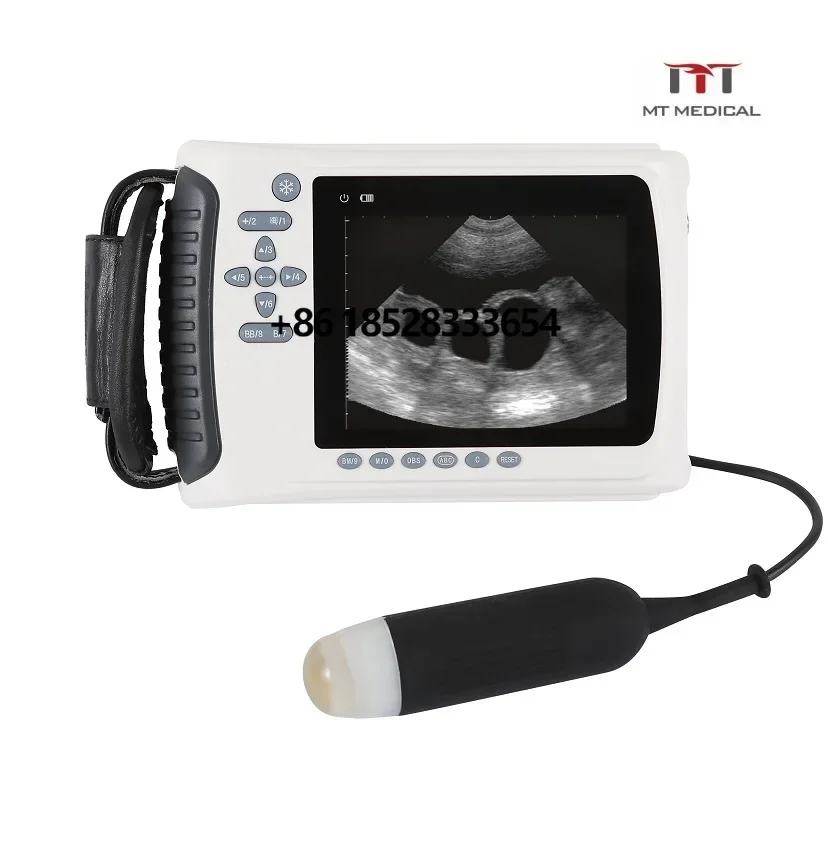 MT MEDICAL Mini hand-held pet medical ultrasound scanner portable animal medical ultrasound device
MT MEDICAL Mini hand-held pet medical ultrasound scanner portable animal medical ultrasound device