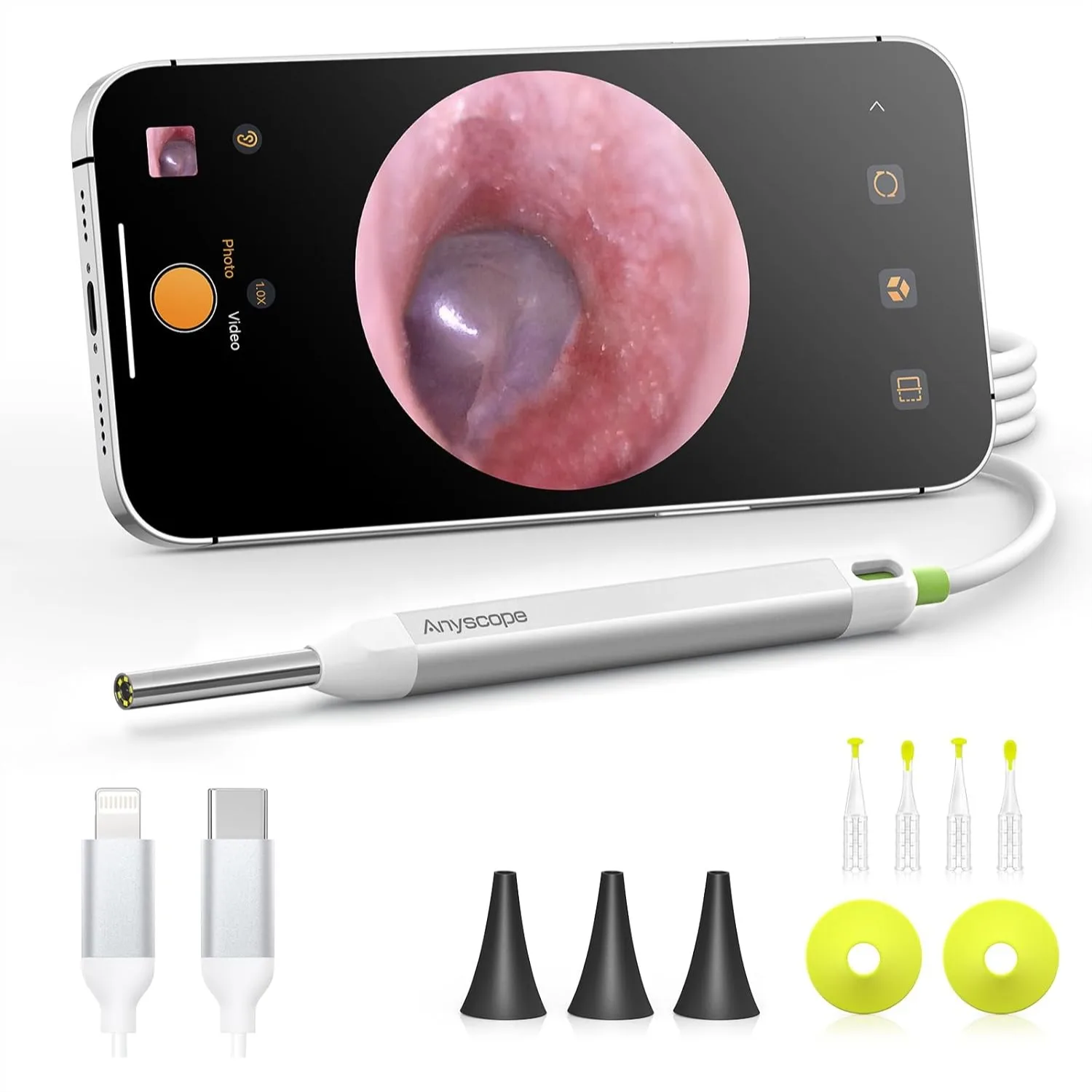Digital Otoscope with Gyroscope HD Ear Camera for Ear Wax Removal, Compatible with iPhone and Android
Digital Otoscope with Gyroscope HD Ear Camera for Ear Wax Removal, Compatible with iPhone and Android