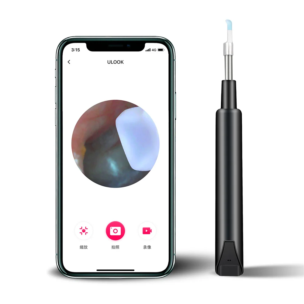 Factory Direct Price Visual Ear Picking Tool Wireless Ear Wax Re-moval Otoscope High-definition Ear Cleaning Tool
Factory Direct Price Visual Ear Picking Tool Wireless Ear Wax Re-moval Otoscope High-definition Ear Cleaning Tool