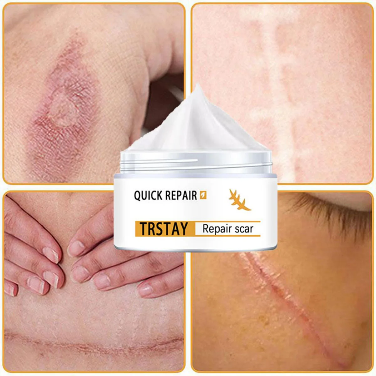 Крем для восстановления TRSTAY, нежный, не раздражающий металболизм кожи, способствует увлажню беременности, уход за страрой Gravidarum
Крем для восстановления TRSTAY, нежный, не раздражающий металболизм кожи, способствует увлажню беременности, уход за страрой Gravidarum