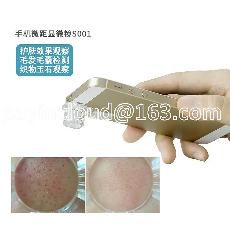 Skin Hair Follicle Hair Scalp Phone Magnifier Microscope Macro Detection Pore Blackhead Lens S001
Skin Hair Follicle Hair Scalp Phone Magnifier Microscope Macro Detection Pore Blackhead Lens S001