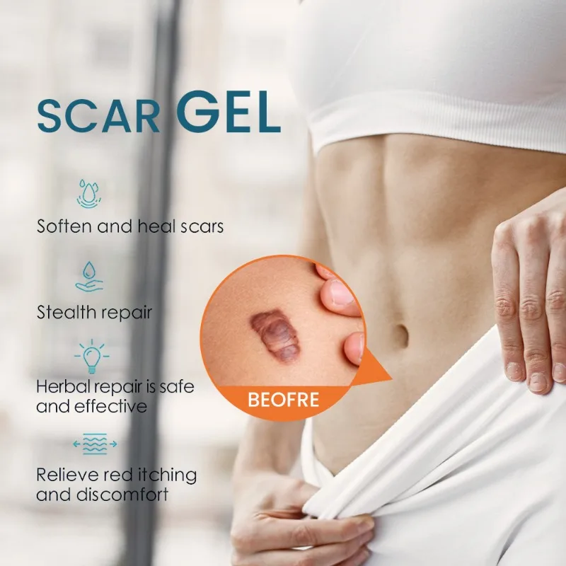 Гель для выцветания шрамов для ожогов, роскошный крем, крем для ухода за кожей K10144 
Гель для выцветания шрамов для ожогов, роскошный крем, крем для ухода за кожей K10144