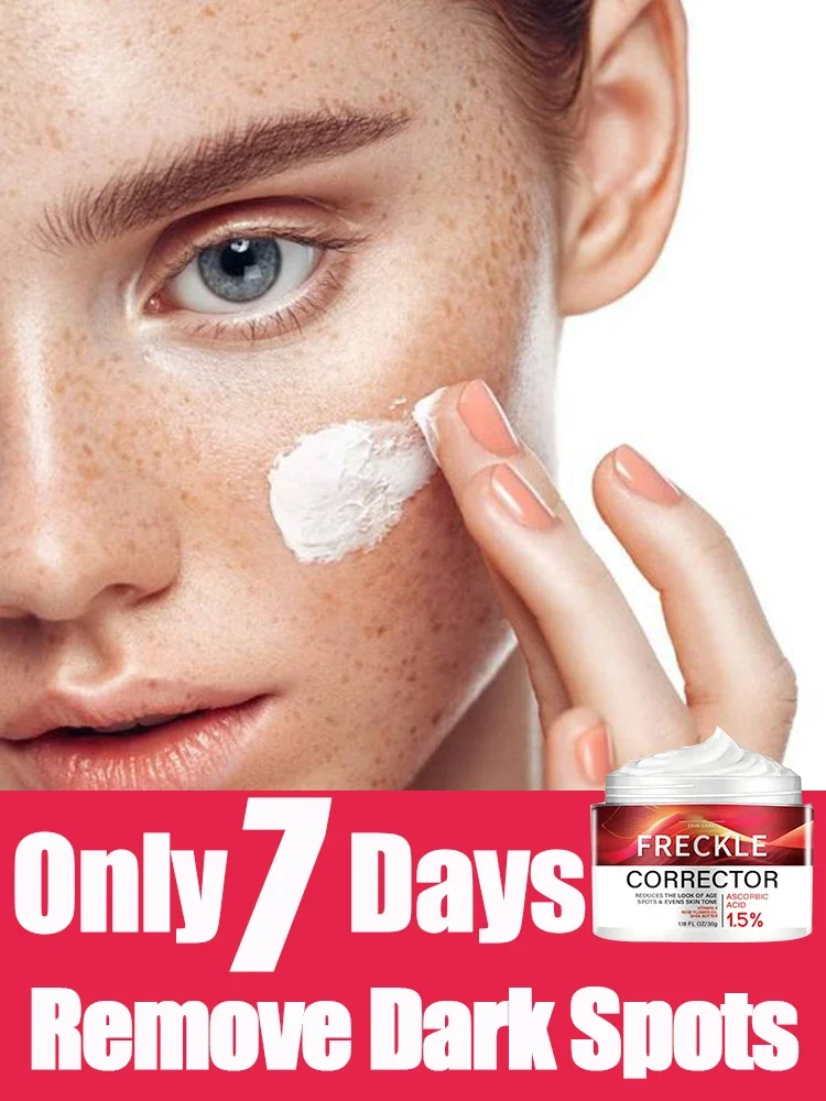 Anti-Freckle Skin Whitening Cream Removes Melanin Dullness Reduces Age Spots Freckles Facial Moisturizing Brightening Face Care
Anti-Freckle Skin Whitening Cream Removes Melanin Dullness Reduces Age Spots Freckles Facial Moisturizing Brightening Face Care