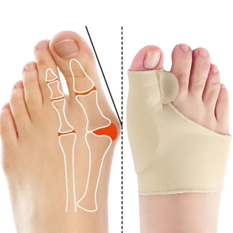 2Pcs=1Pair Toe Corrector Orthotics Feet Foot Care Bone Thumb Adjuster Correction Soft Pedicure Socks Bunion Straightener
2Pcs=1Pair Toe Corrector Orthotics Feet Foot Care Bone Thumb Adjuster Correction Soft Pedicure Socks Bunion Straightener