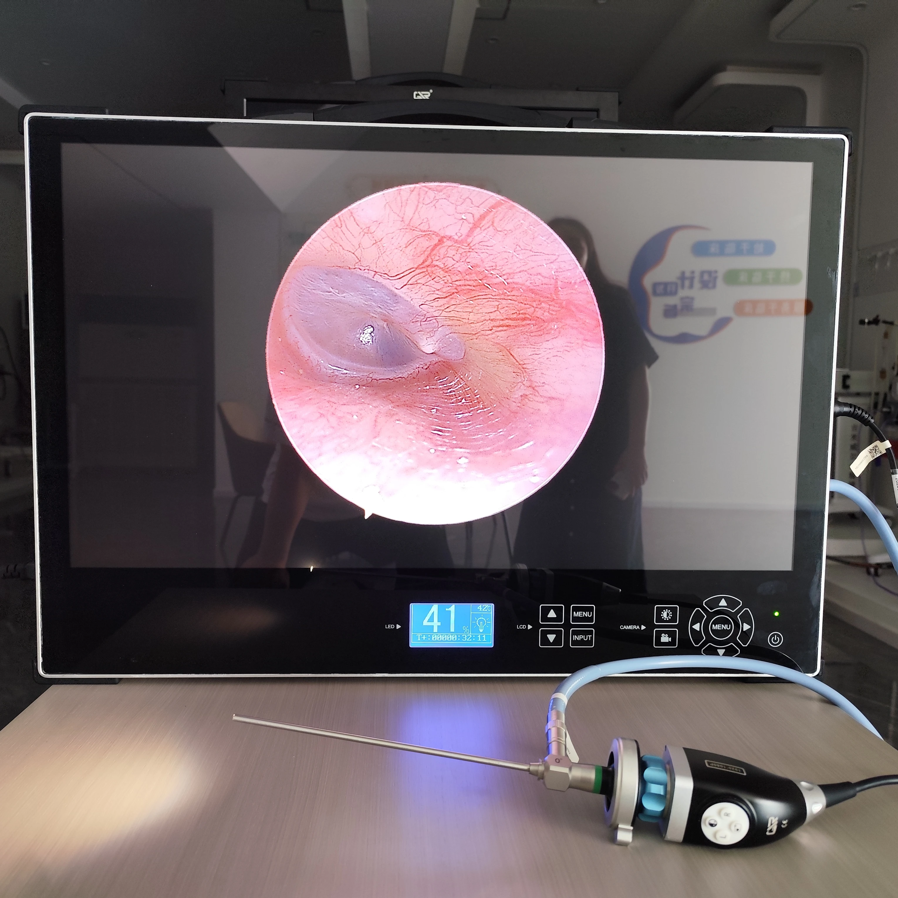 Medical Endoscopic System FHD 1080P Portable Endoscopic Laparoscopic Otolaryngology Gynecological Endoscopic
Medical Endoscopic System FHD 1080P Portable Endoscopic Laparoscopic Otolaryngology Gynecological Endoscopic