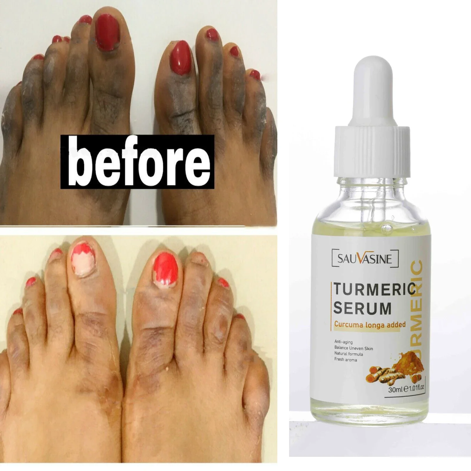 Turmeric Lemon Oil Skin Glow To Lightening Acne Dark Patches, Acne Bright Skin Dark Spot Corrector Face Whitening
Turmeric Lemon Oil Skin Glow To Lightening Acne Dark Patches, Acne Bright Skin Dark Spot Corrector Face Whitening