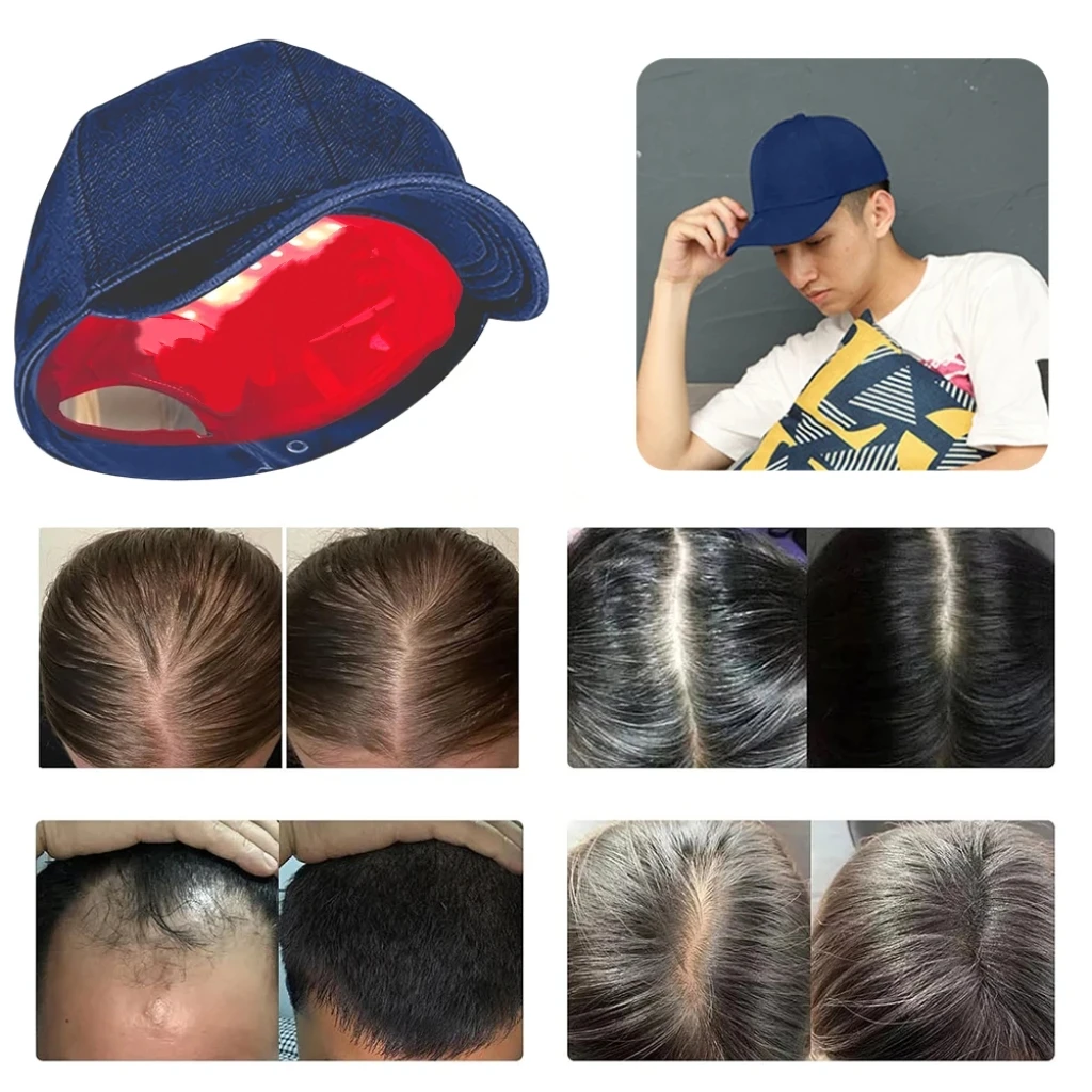 Best LLLT Laser Comb Cap for Hair Loss Prevention Stimulates Hair Follicles Growth Phototherapy Device
Best LLLT Laser Comb Cap for Hair Loss Prevention Stimulates Hair Follicles Growth Phototherapy Device