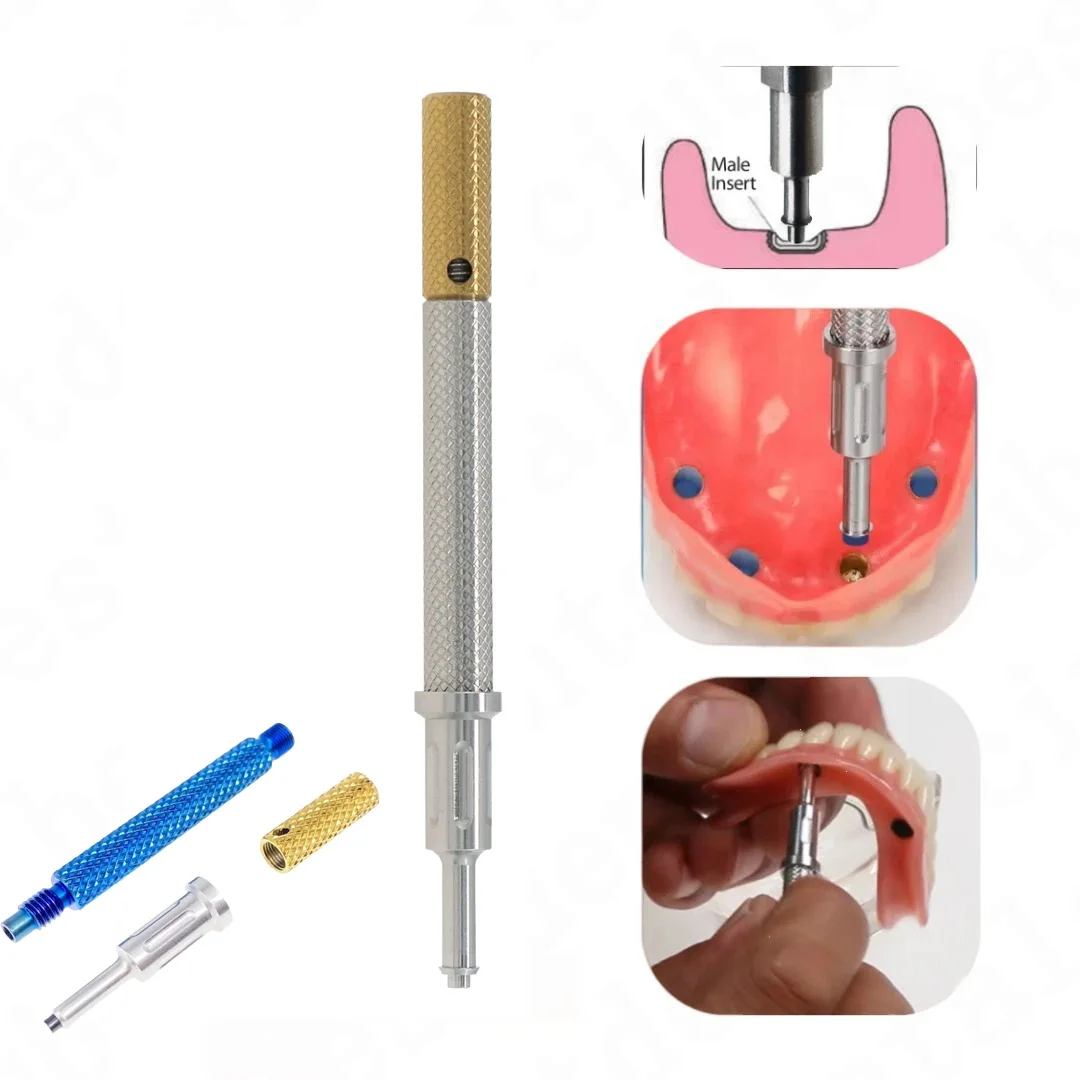 Dental Extraction Locator Core Universal Implant Retention Caps Insertion 3-in-1
Dental Extraction Locator Core Universal Implant Retention Caps Insertion 3-in-1