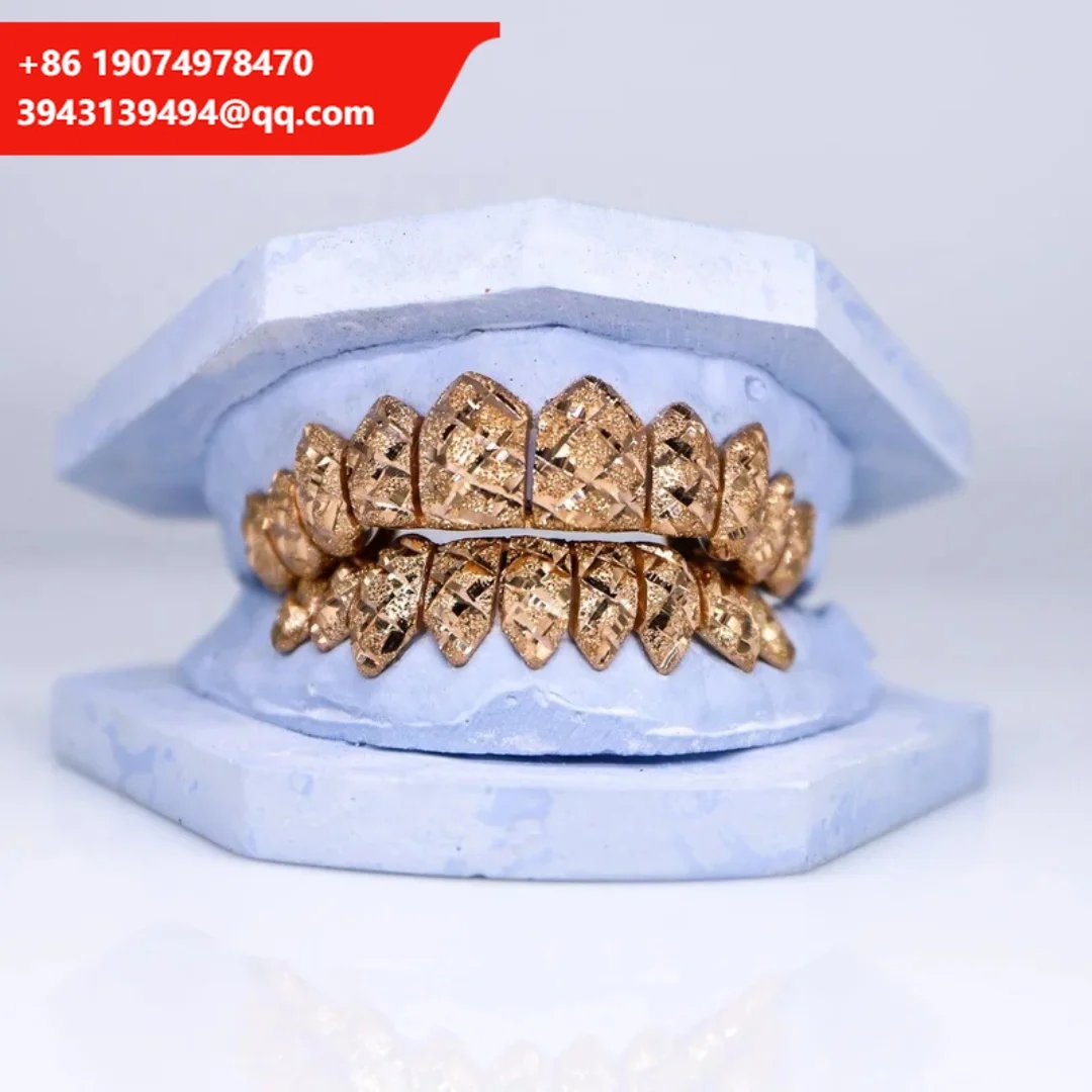 Diamond Cut Gold Grills For Teeth 925 Sliver Gold Plated Real 10K 14K 18K Solid Gold Custom Teeth Grillz For Men And Women
Diamond Cut Gold Grills For Teeth 925 Sliver Gold Plated Real 10K 14K 18K Solid Gold Custom Teeth Grillz For Men And Women