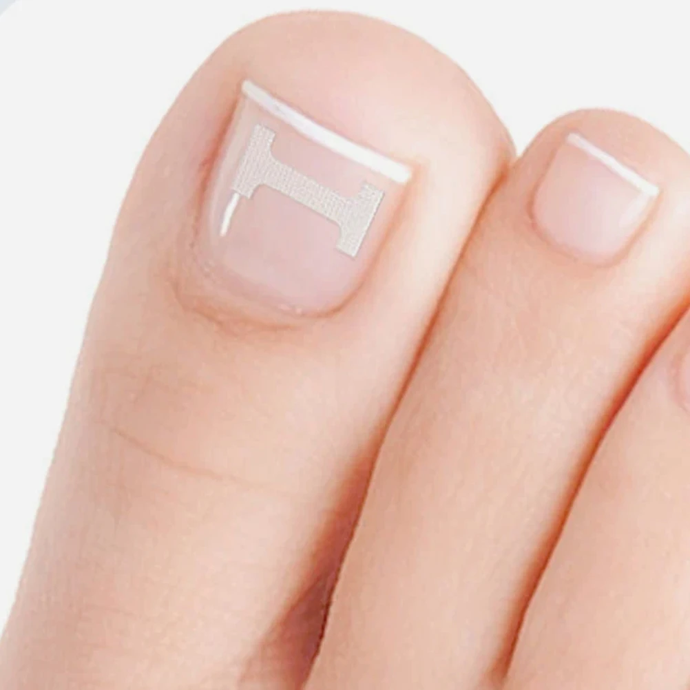 10Pcs Toenail Correction Stickers Stretchable Patch Breathable Material Invisible Design for Walking Comfortably
10Pcs Toenail Correction Stickers Stretchable Patch Breathable Material Invisible Design for Walking Comfortably