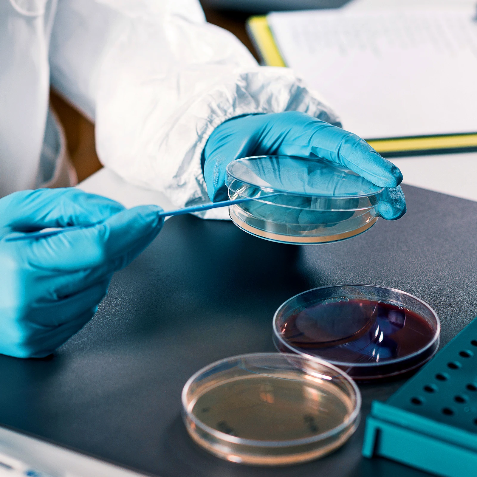 20 Pcs Mushroom Nutrient Agar Plate Travel Growth Plates Mushrooms Cell Culture Dish
20 Pcs Mushroom Nutrient Agar Plate Travel Growth Plates Mushrooms Cell Culture Dish