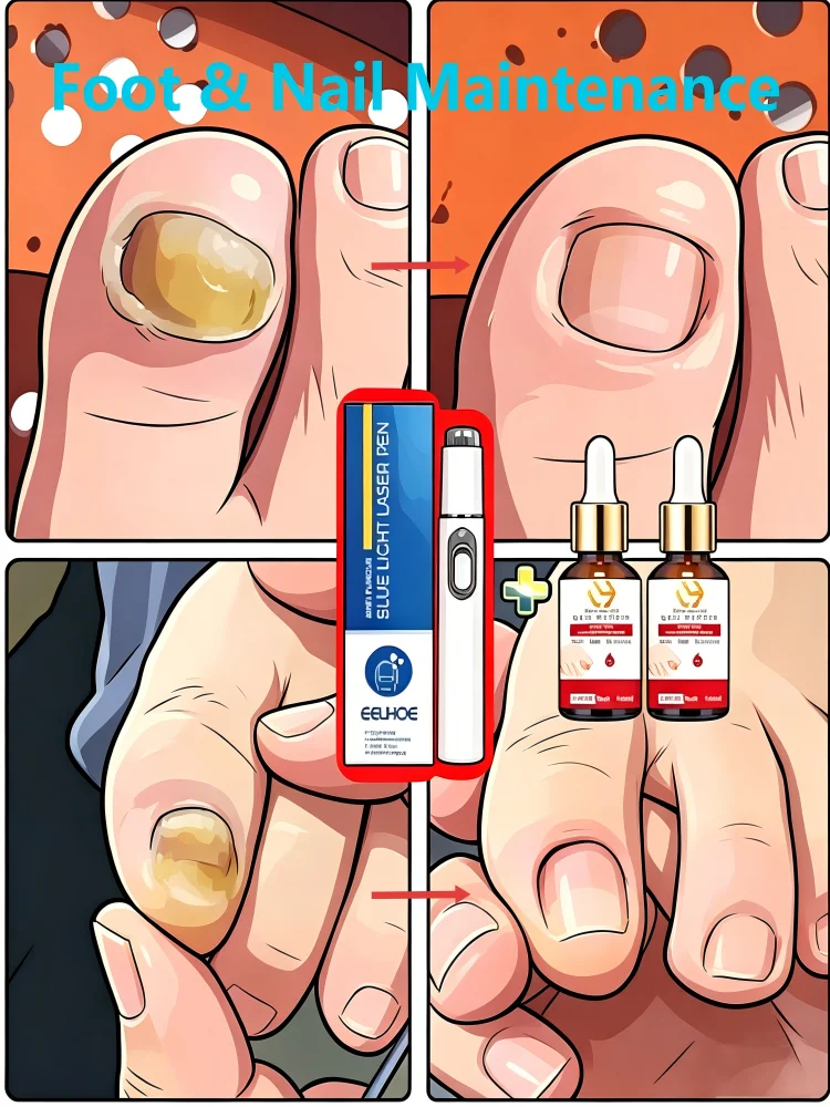 2026 New,2-in-1,Nail repair equipment,Daily External Care,Lightweight,Group Sets More Favorable Price
2026 New,2-in-1,Nail repair equipment,Daily External Care,Lightweight,Group Sets More Favorable Price