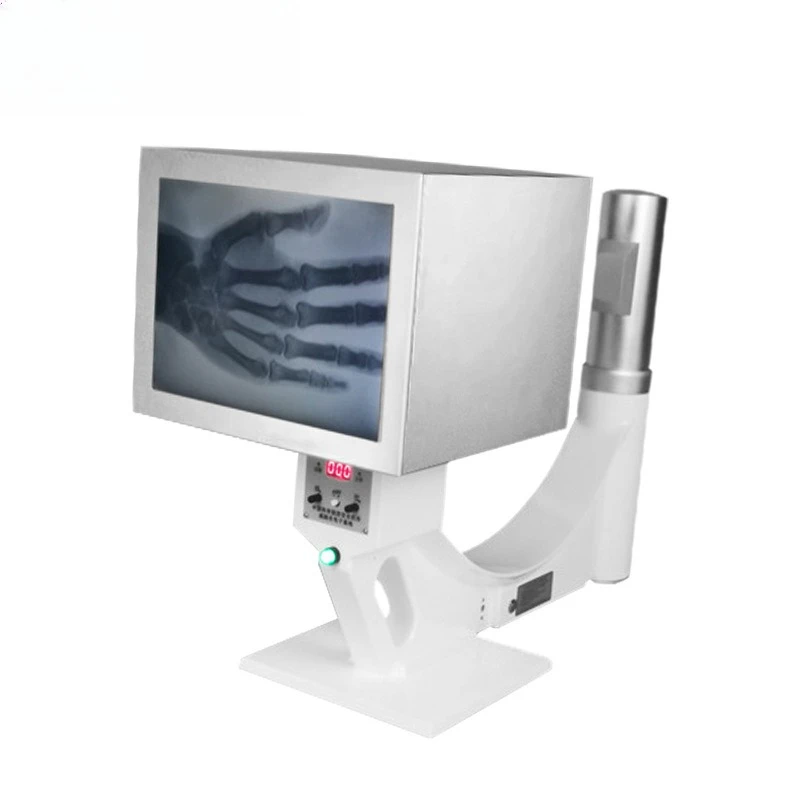 X-ray machine portable industrial X-ray machine non-destructive testing high definition die-casting ancient coin orthopedic pet
X-ray machine portable industrial X-ray machine non-destructive testing high definition die-casting ancient coin orthopedic pet