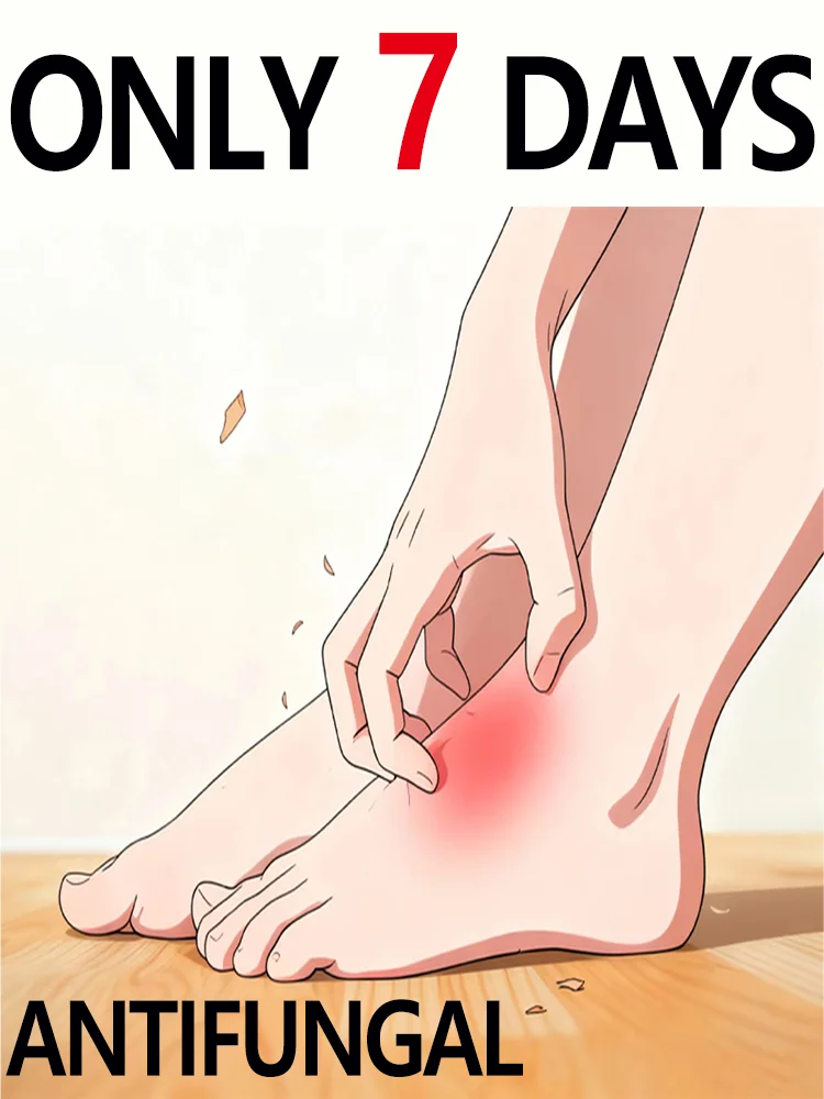 Из запаха стопы, зудящие ноги
Из запаха стопы, зудящие ноги