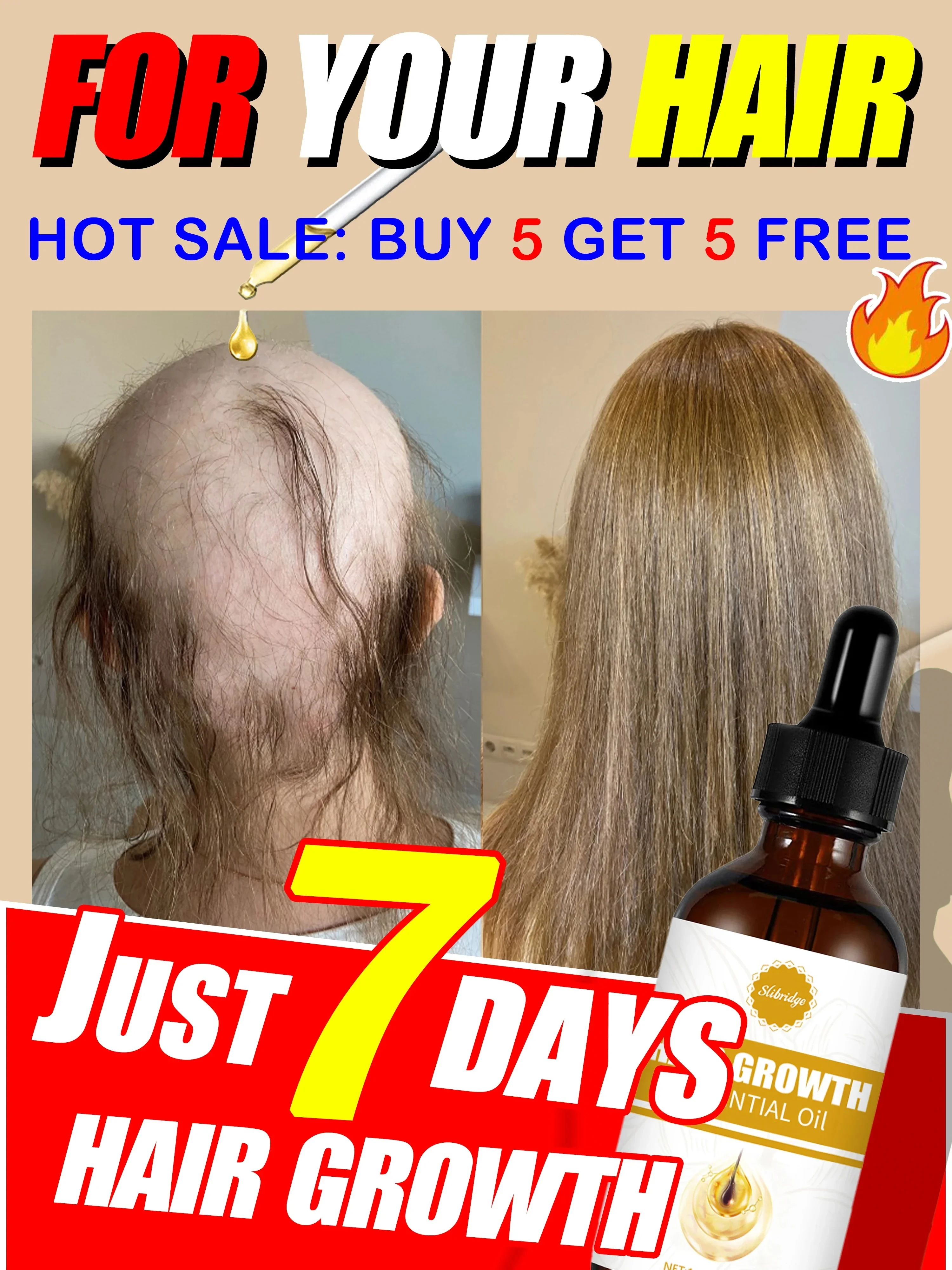 Sólo se necesitan 7 días para reparar la calvicie. El aceite esencial para el crecimiento del cabello puede reparar eficazmente
Sólo se necesitan 7 días para reparar la calvicie. El aceite esencial para el crecimiento del cabello puede reparar eficazmente