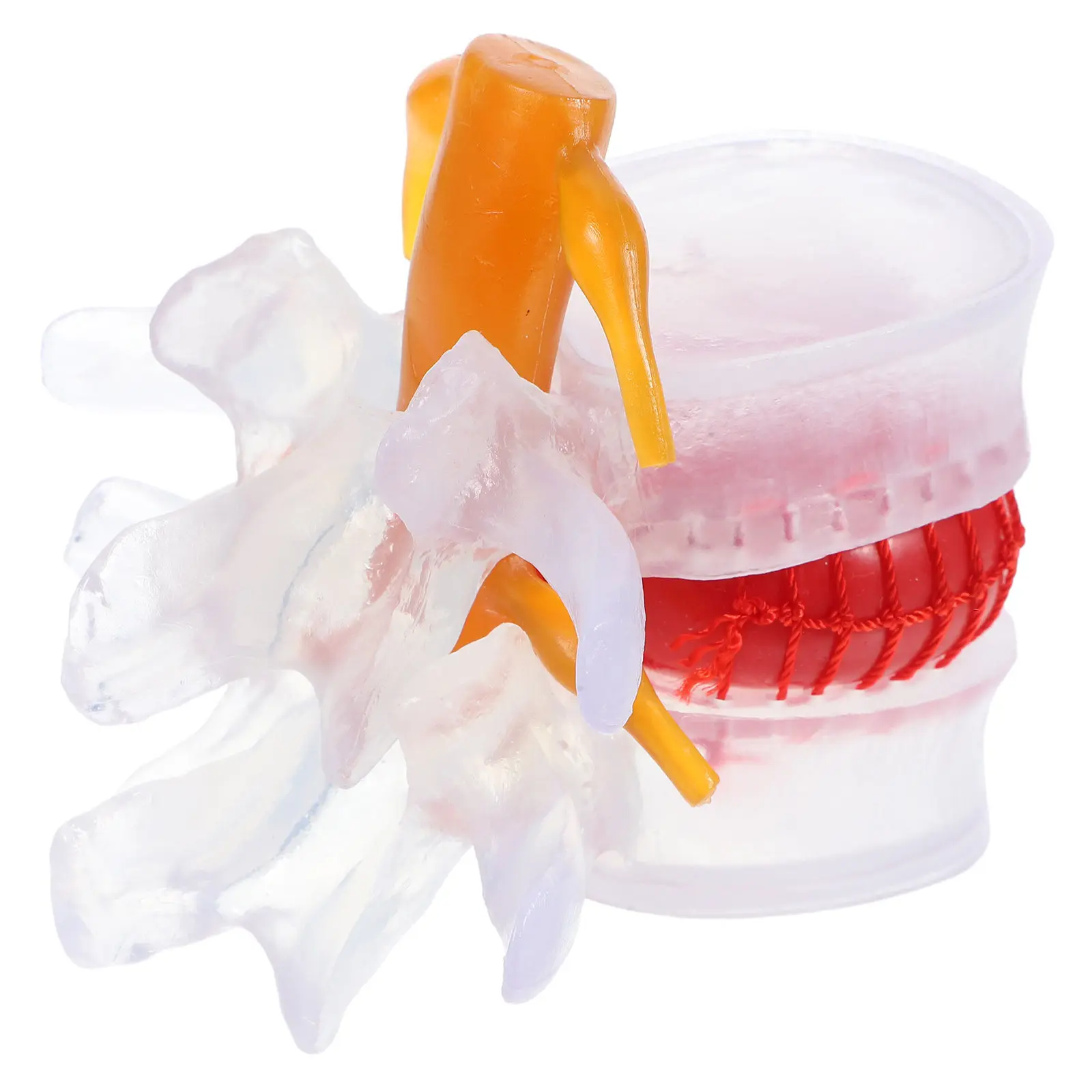 Lumbar Disc Herniation Spine Teaching Demonstration Human Lumbar Spine Transparent Resin Rubber Training Research
Lumbar Disc Herniation Spine Teaching Demonstration Human Lumbar Spine Transparent Resin Rubber Training Research