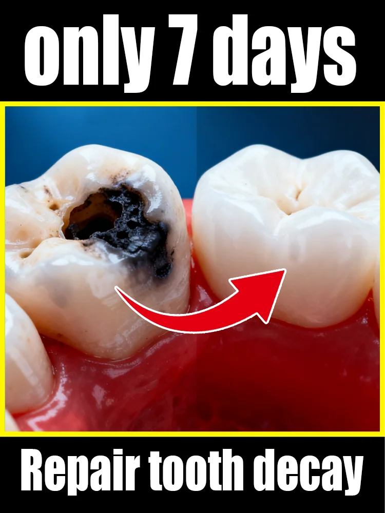 Say goodbye to cavities and regain your perfect smile!
Say goodbye to cavities and regain your perfect smile!