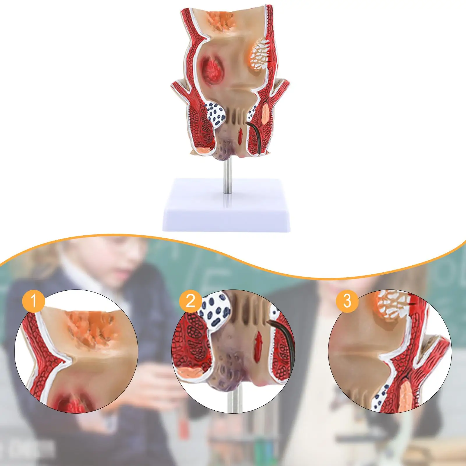 Human Pathological Rectal Model Practical Educational Display Tool Teaching Aid for Research Learning School Study Classroom
Human Pathological Rectal Model Practical Educational Display Tool Teaching Aid for Research Learning School Study Classroom