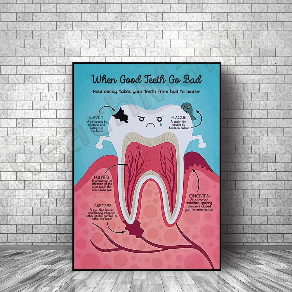 How decay can make your teeth go from bad to bad poster, dental office decoration, bad tooth wall art when good teeth go bad
How decay can make your teeth go from bad to bad poster, dental office decoration, bad tooth wall art when good teeth go bad