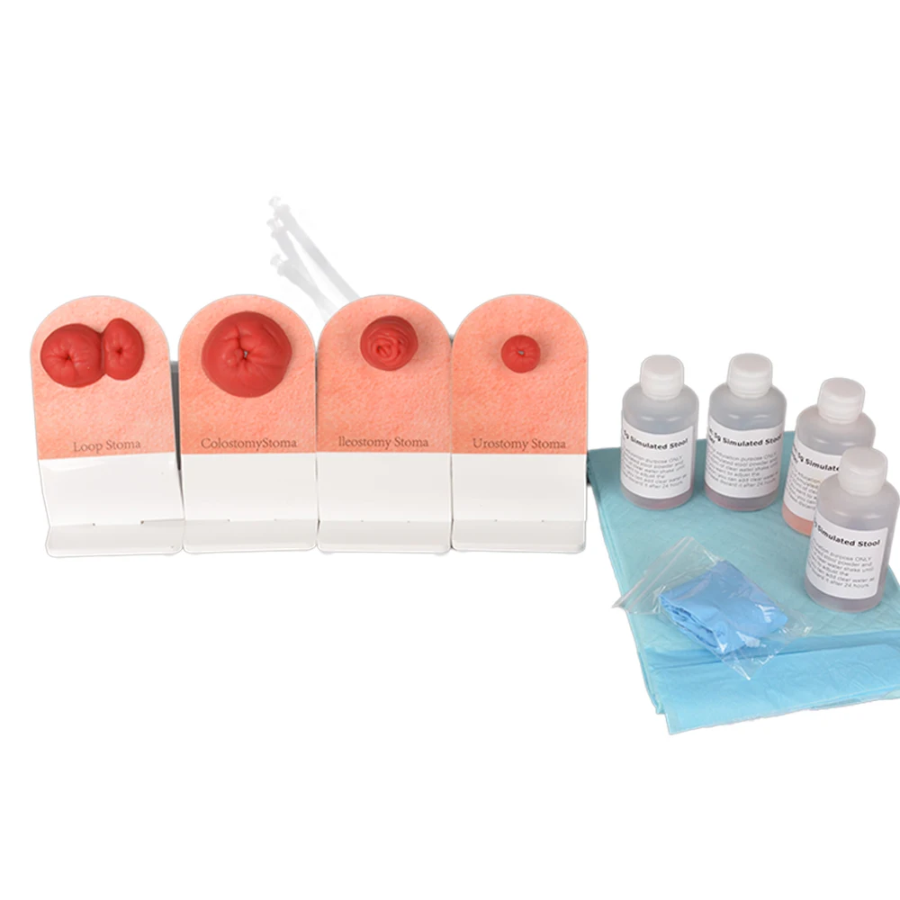 Tabletop Simulation Fecal Ostomy Model for Skill Enhancement and Practical Application
Tabletop Simulation Fecal Ostomy Model for Skill Enhancement and Practical Application