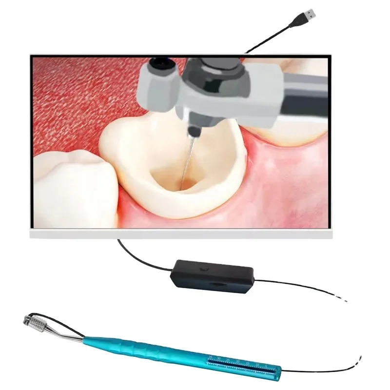 HD Micro Oral Recording Device Micro Lens Visual Micro Recording Device for Root Canal Treatment
HD Micro Oral Recording Device Micro Lens Visual Micro Recording Device for Root Canal Treatment