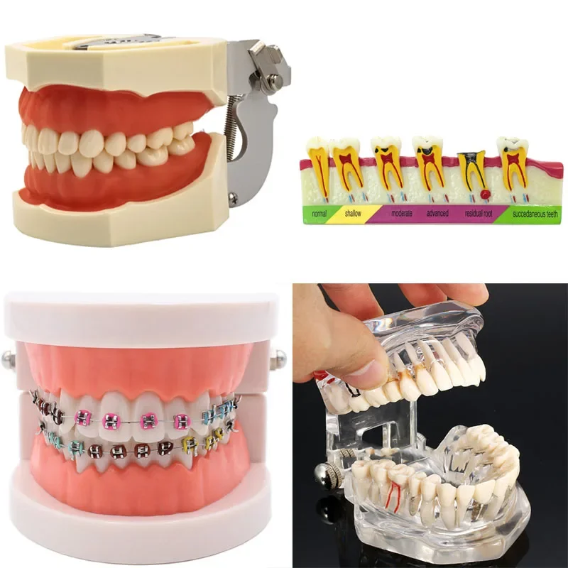 Standard Dental Typodont Model with Removable Teeth and Gums for Demonstration and Training
Standard Dental Typodont Model with Removable Teeth and Gums for Demonstration and Training