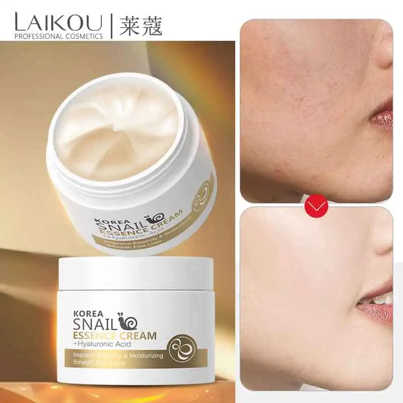 Лицо улитки крем с гиалуроновой кислотой против морщин анти-старения для лица дневной коллагеновый крем увлажняющий питательный жесткой кожи Сыворотки уход
Лицо улитки крем с гиалуроновой кислотой против морщин анти-старения для лица дневной коллагеновый крем увлажняющий питательный жесткой кожи Сыворотки уход