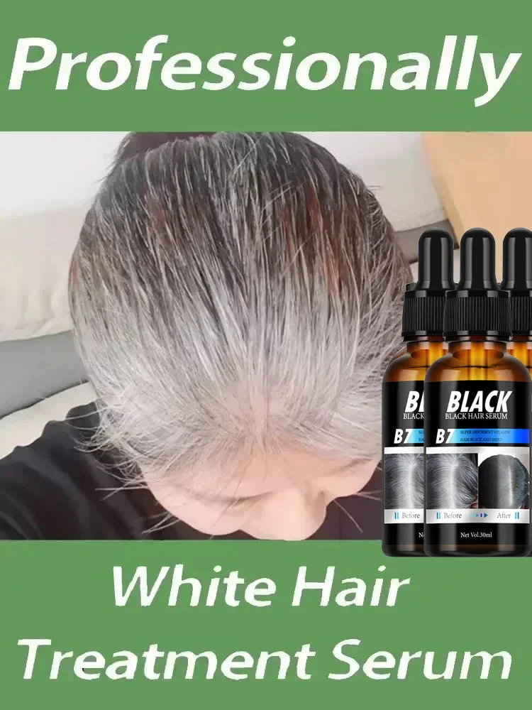 White hair killer, remove gray hair and restore natural hair color in 7 days Healthy,quickly turns white airh into black
White hair killer, remove gray hair and restore natural hair color in 7 days Healthy,quickly turns white airh into black