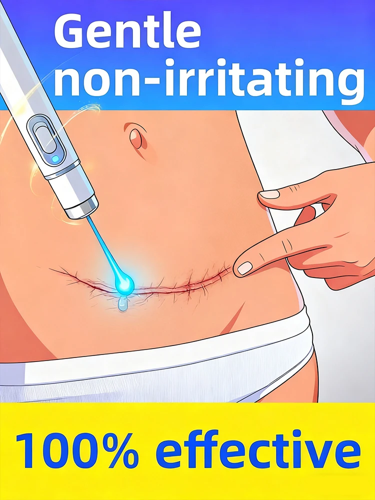 Новые лазерные ручки 2-го поколения для решения проблем шрамов и сохраняют здоровью кожи.
Новые лазерные ручки 2-го поколения для решения проблем шрамов и сохраняют здоровью кожи.