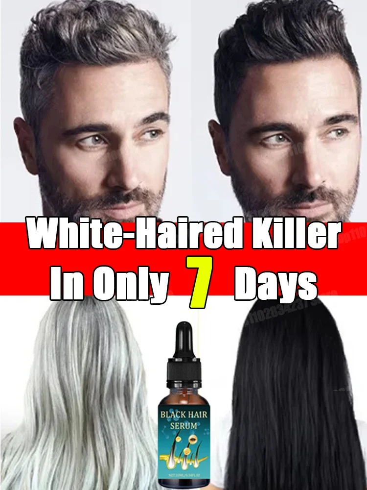 Revitalize Your Hair Color and Health with Anti-Grey Hair Natural Anti-Grey Serum Remedy Healthy Essence Serum
Revitalize Your Hair Color and Health with Anti-Grey Hair Natural Anti-Grey Serum Remedy Healthy Essence Serum