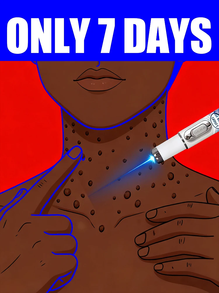 Лазер 5-го поколения: Попрощайтесь с бородавками (унисекс)
Лазер 5-го поколения: Попрощайтесь с бородавками (унисекс)