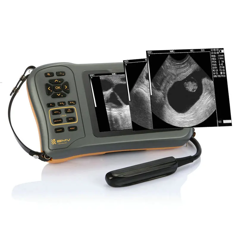 BMV Farmscan L60, свинья, крупный рогатого скота, корова, эквин, preg, Нэнси, ветеринарное оборудование для больших животных
BMV Farmscan L60, свинья, крупный рогатого скота, корова, эквин, preg, Нэнси, ветеринарное оборудование для больших животных