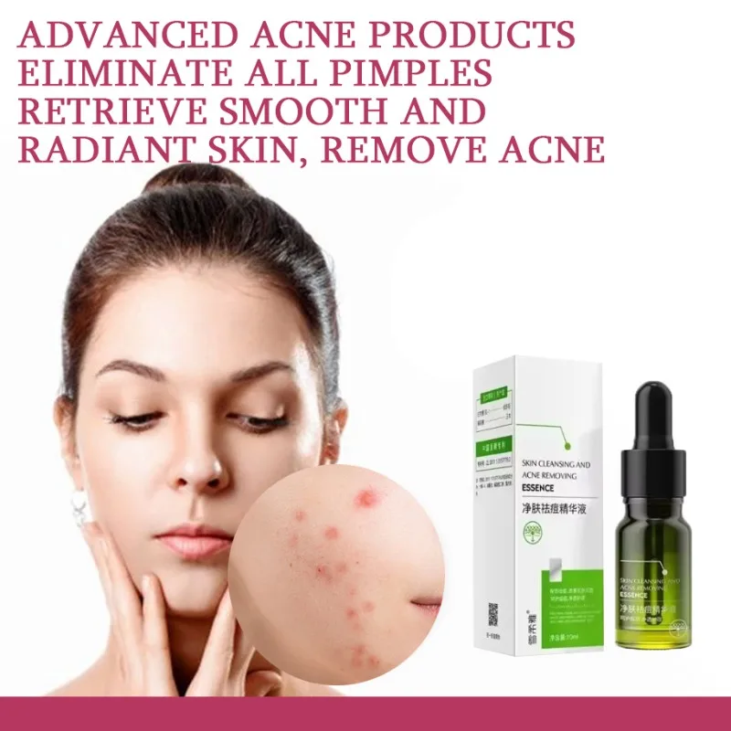 Acne Removing&Anti acne Cream Treatment of Acne Marked Skin Care Whitening&Acne Removing face cream Smooth&Whitening face cream
Acne Removing&Anti acne Cream Treatment of Acne Marked Skin Care Whitening&Acne Removing face cream Smooth&Whitening face cream